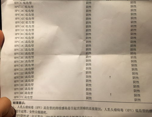 医生回应，7岁女孩天生异瞳，医学奇迹还是罕见病例？